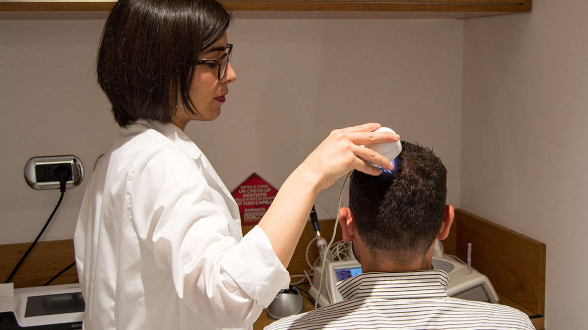 Consulenze Caduta Capelli